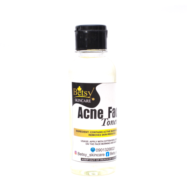 Acne Face Toner