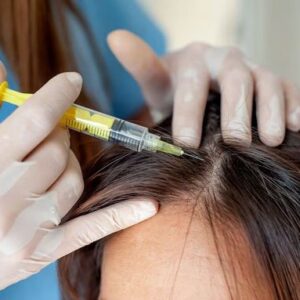 PRP TREATMENT